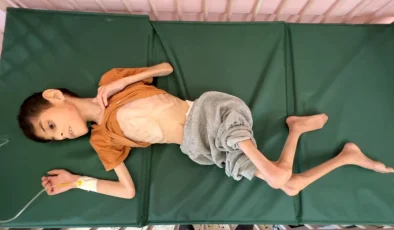 Gazze’deki çocuklar susuzluk ve yetersiz beslenmeyle mücadele ediyor