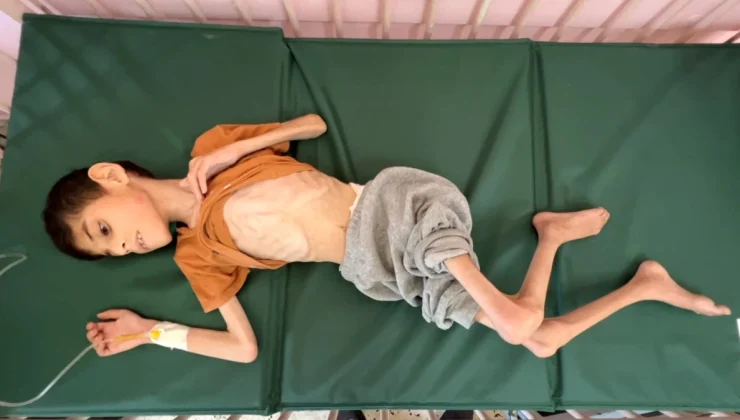 Gazze’deki çocuklar susuzluk ve yetersiz beslenmeyle mücadele ediyor